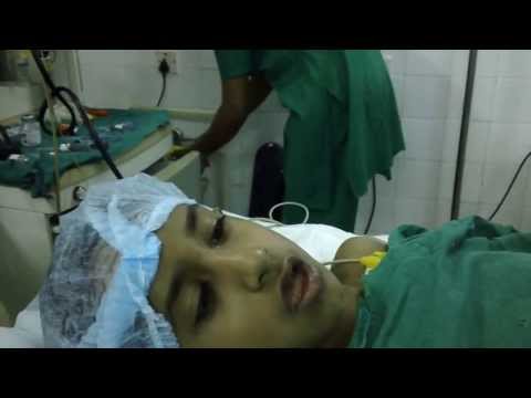 Adenoid face and snoring:Treatment