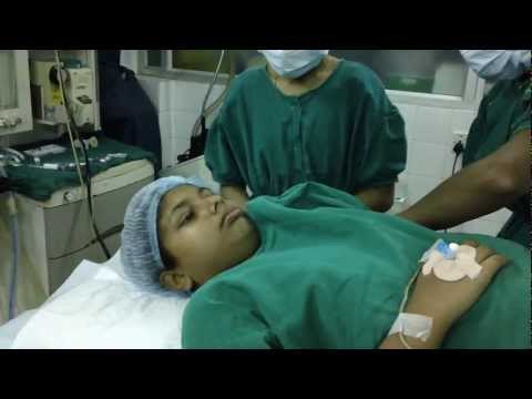 Adenoid,Mouth Breathing and Dental Malocclusion