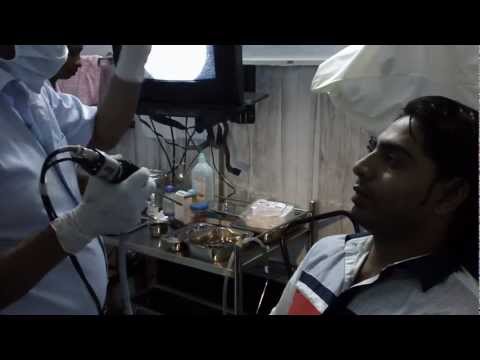 Adenoid Stone (Adenoidolith) removed from Aman’s Throat