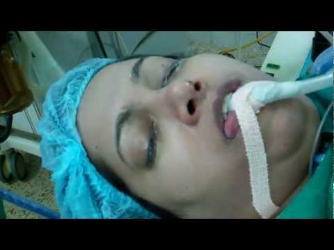 After Anesthesia: Extubating the Patient