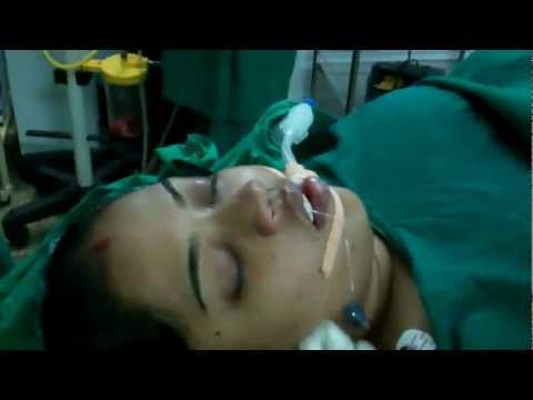 After Septoplasty:Post Op Care