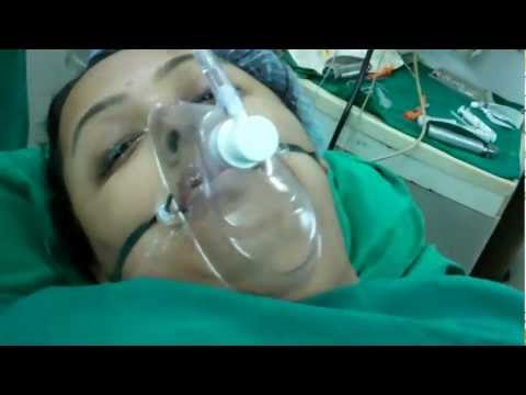 Anesthesia: Extubating an obese snorer after sleep surgery