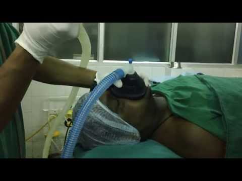 Anesthesia for Snoring Surgery