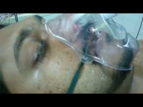 Anesthesia Sleep Surgery:After Extubation:Dr.K.O.Paulose FRCS