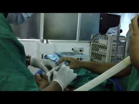Anesthetising a Snoring Patient