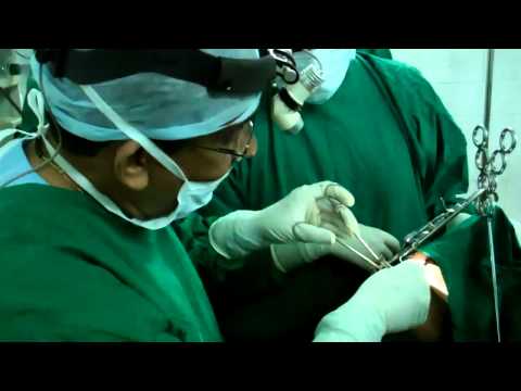 Bad Breath:Halitosis:Tonsillolith Treated By Tonsillectomy