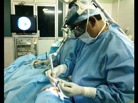 Bleeding from Nose-Rniosporidiosis