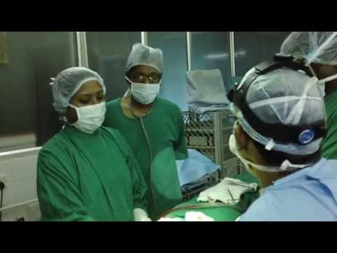 Bulbous Nasal Tip in Women-Tip Plasty