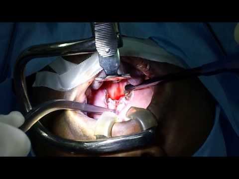 Can Snoring ruin a marriage?