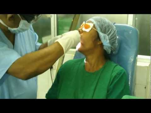 Cancerophobia:Fear of Throat Cancer:Biopsy