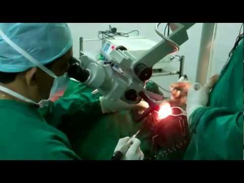 Chronic Ear Disease in India:Socio economic Issues in Treatment