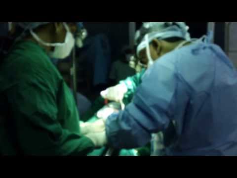 Crooked Nose Corrected