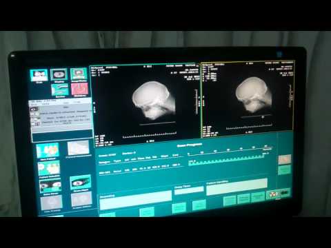 CT Scan of Nose and Sinus:How It’s done?