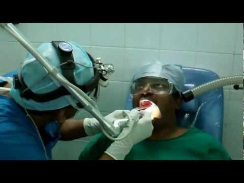 Cure for Snoring and Sleep Apnea:Laser Surgery
