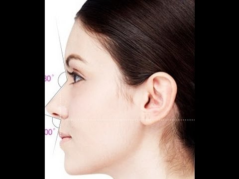 Do You Want An Ideal Nose ? Nose Job in Women (Rhinoplasty)