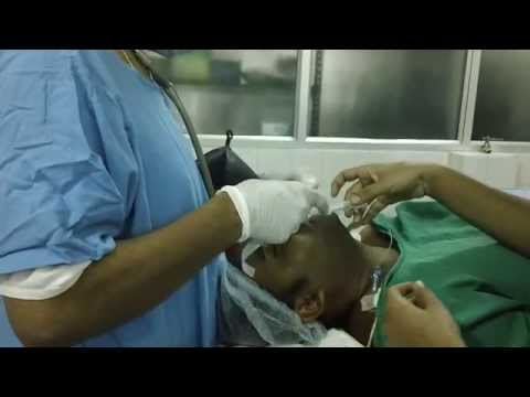 Dr.Thomas is putting a Snoring Patient to Sleep-GA