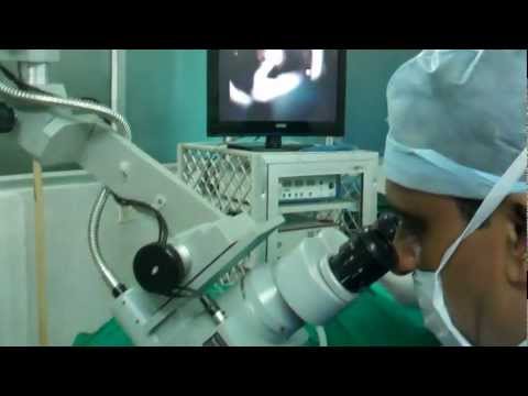 Ear Operation for blocked Ears:Myringotomy and Grommet