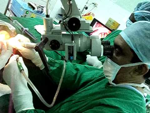 Ear Surgery-Cholesteatoma.