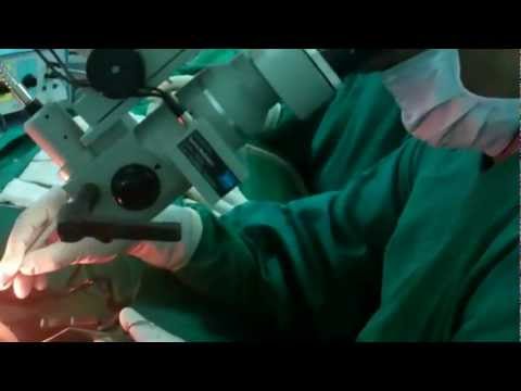 Ear Surgery in Jubilee Hospital, Trivandrum-1