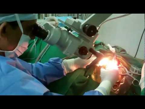 Ear Surgery In Jubilee Hospital, Trivandrum, South India