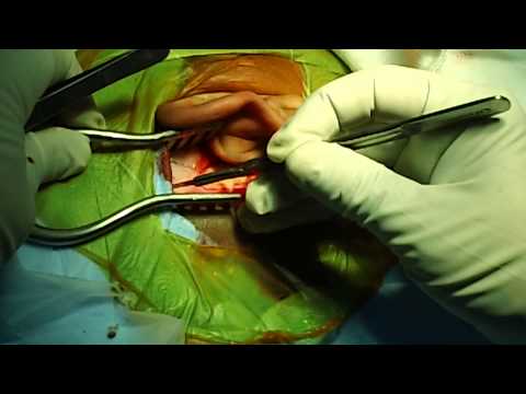 Ear Surgery In Trivandrum Kerala India