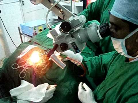 Ear Surgery – Mastoidectomy Operation 2.