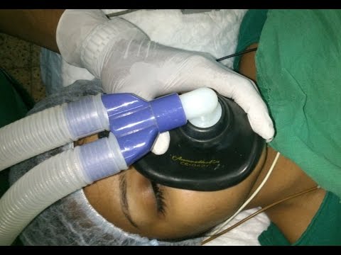 Endotracheal Intubation Procedure-GA for Laser Surgery Nose