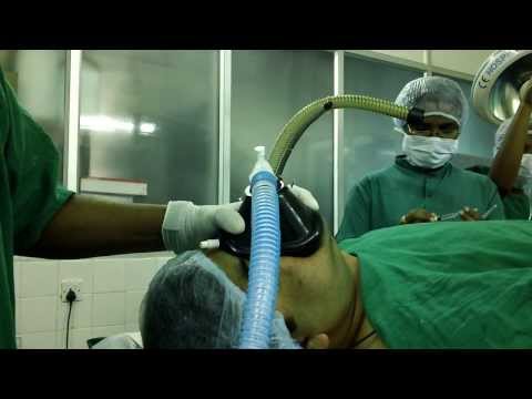 ENT-Anesthesia for Nasal Surgery