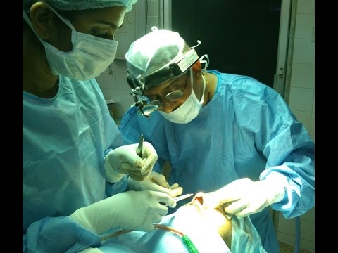 Ethnic Rhinoplasty – Dravidian Nose