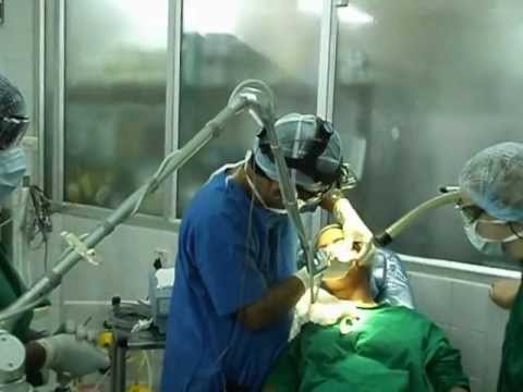 Facial cosmetic surgery by Laser in Trivandrum, India.
