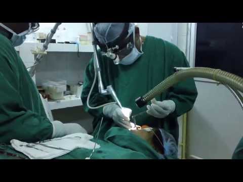 Facial Moles and Nasal Allergy Treated by Laser