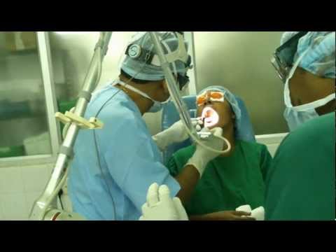 Fear of Throat Cancer and Laser Treatment