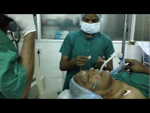 Fr.Joseph is anesthetized for nasal surgery