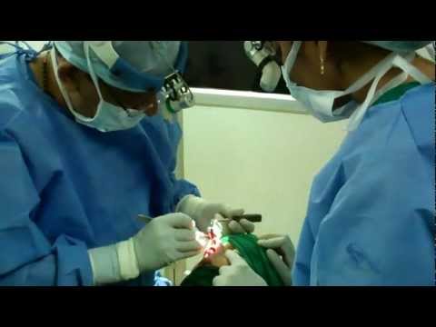 Functional and Cosmetic Surgery of Nose for an Indian Girl