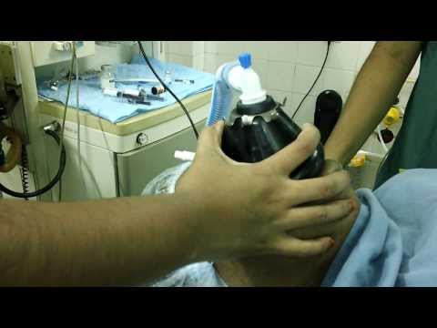 GA Intubation-ENT Surgery