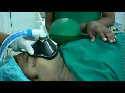 GA:Waking up the patient after Sleep Surgery:Dr.K.O.Paulose FRCS