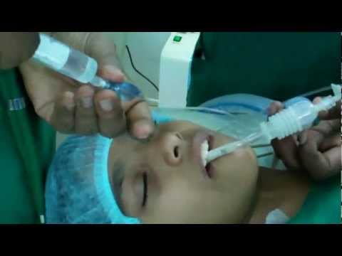 General Anesthesia: Intubating Jasmine for Laser Surgery