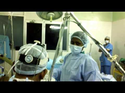 Halitosis (Bad Breath) Treatment By Coblator and Co2 Laser
