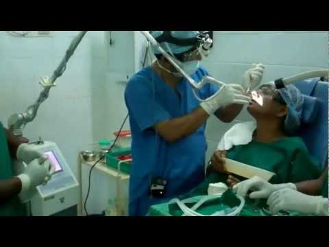 Hay Fever Sneezing: Laser Cure