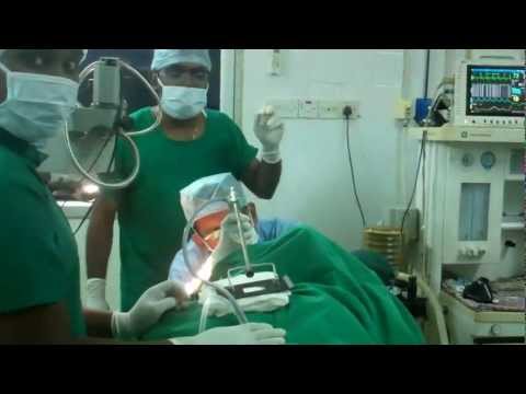 Hoarseness of Voice: Vocal Cord Polyp (Reinkes Edema)