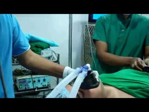 Intubation Can be Difficult in Sleep Apnea Patient