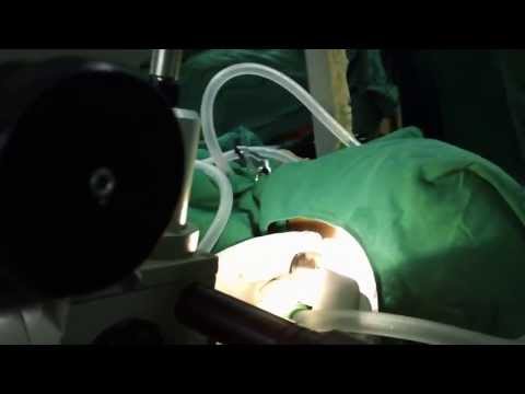 Kids Hearing Loss:Fluid in the Ear