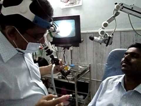 Laryngoscopy in Jubilee Hospital, Trivandrum.