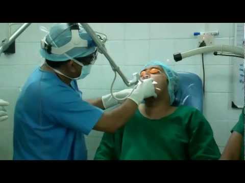 Laser Tonsillectomy and Diathermy Granular Pharynx_LA