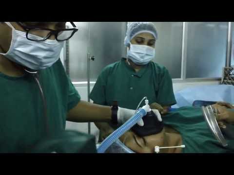 Laser Tonsillectomy:Anesthesia