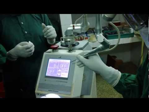 Laser Tonsillectomy Cure Bad Breath