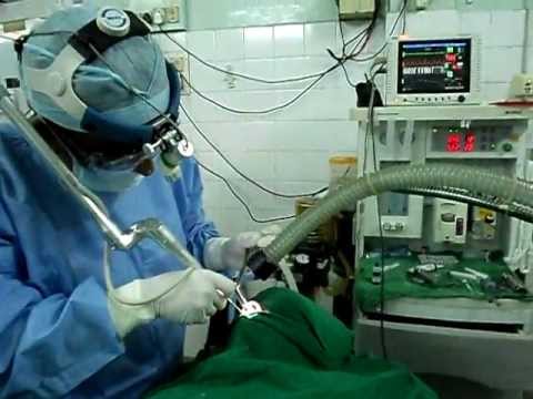 Laser Turbinectomy and Septoplasty by Dr.K.O.Paulose, Jubilee Hospital, Trivandrum.