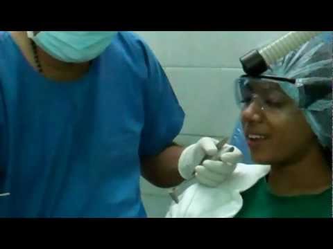 Laser Turbinoplasty:Nasal Allergy Treatment