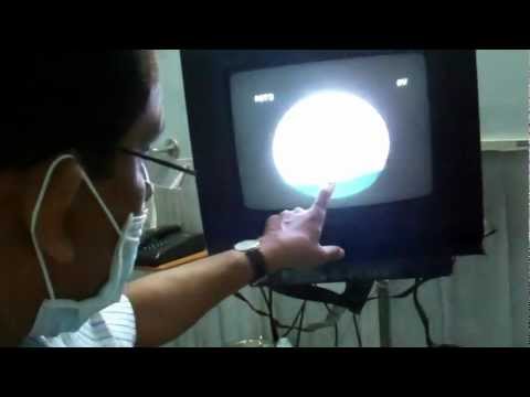 Male Model Hari is Husky:Dr.K.O.Paulose FRCS