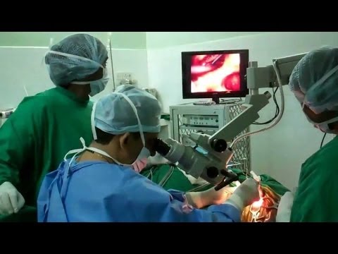 Mastoid Operation-Cholesteatoma-Trivandrum India